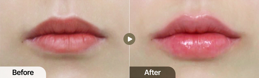 전후사진