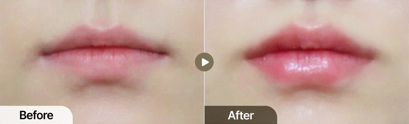 전후사진