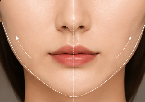 Lip Symmetry